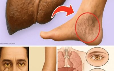 15 señales silenciosas de que su hígado está en problemas – Actúe antes de que sea demasiado tarde