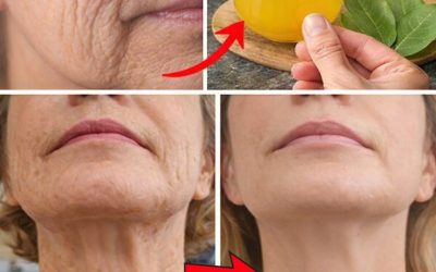 Laurel 1.000.000 de veces más potente que el Botox: elimina TODAS las arrugas, incluso a los 70 años | Salud para adultos mayores