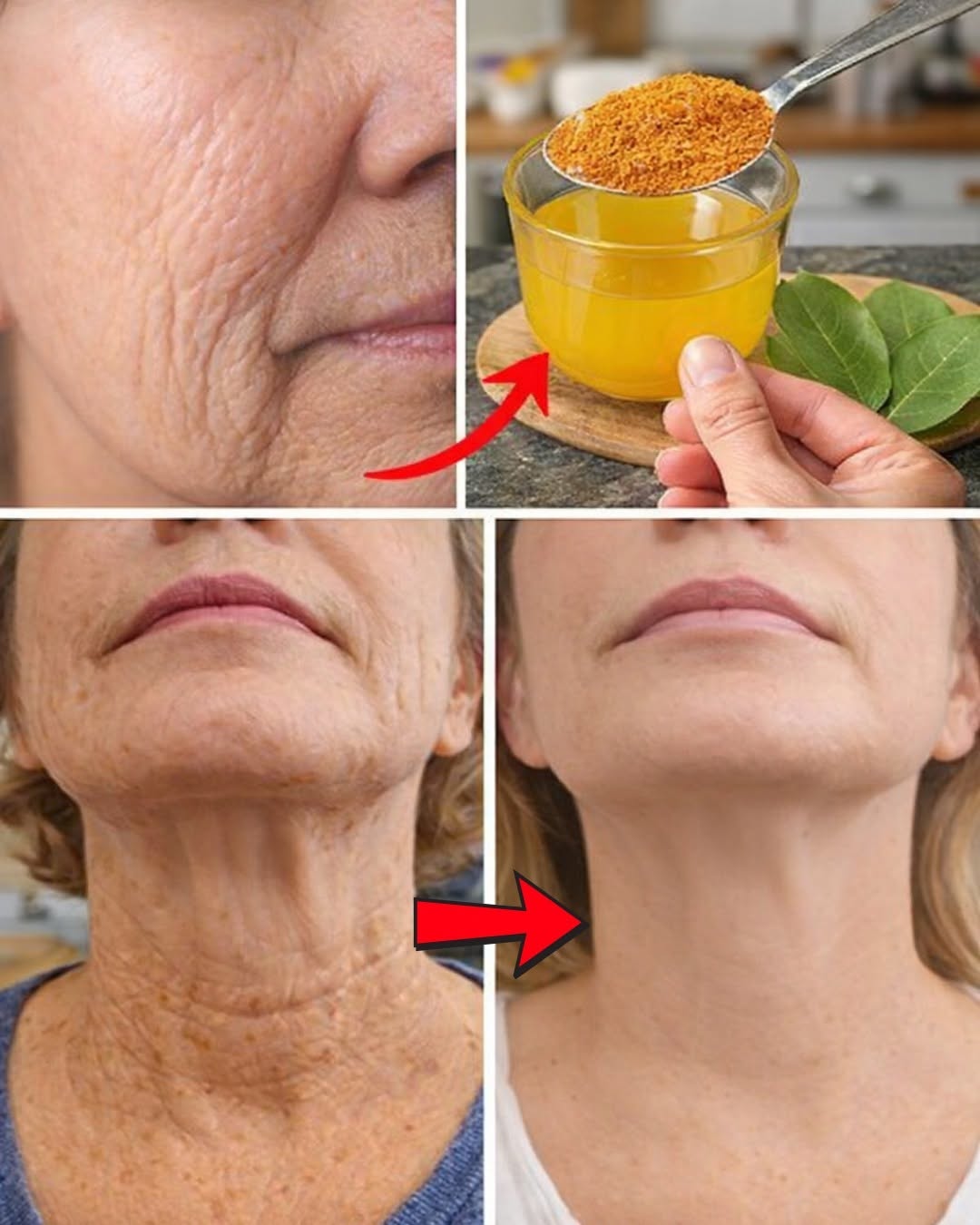 Laurel 1.000.000 de veces más potente que el Botox: elimina TODAS las arrugas, incluso a los 70 años | Salud para adultos mayores