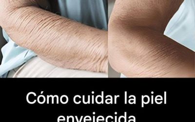 Cómo cuidar la piel envejecida