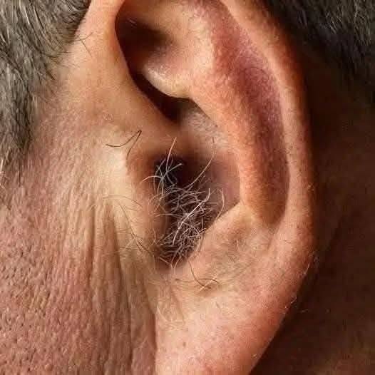 ¿SABÍAS QUE? Si te crece pelo en las orejas, es porque tu cuerpo…