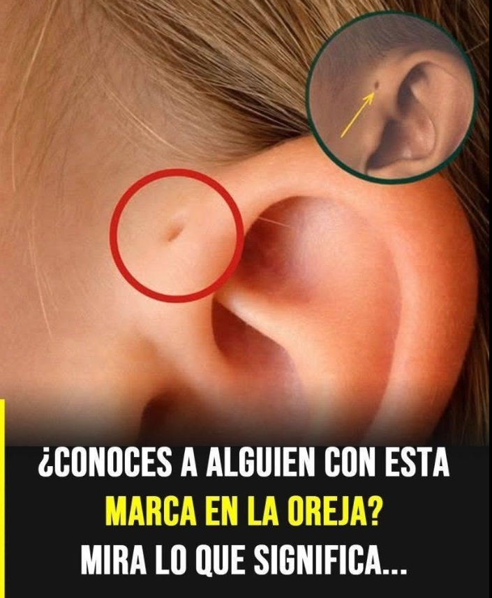 Las personas con este hoyo en la oreja tienen... Ver más